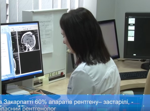 60% рентгенапаратів на Закарпатті – застарілі, – медики (ВІДЕО)