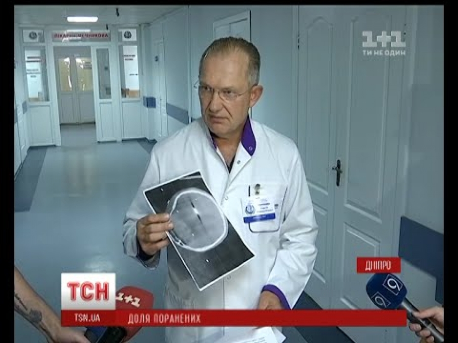 Закарпатець у вкрай важкому стані потрапив до лікарні в Дніпрі після обстрілу в районі шахти Бутівка