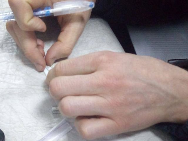 16 згортків із наркотиками та причетний до крадіжки автомобіль виявили в Ужгороді