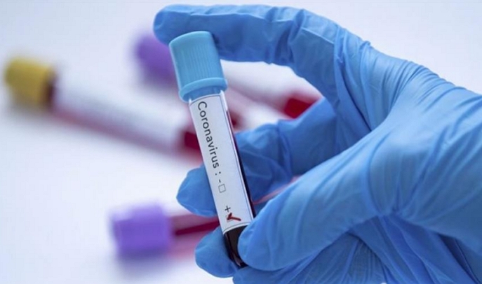 190 мешканцям Рахівщини встановлено діагноз COVID-19, з них 11 померли