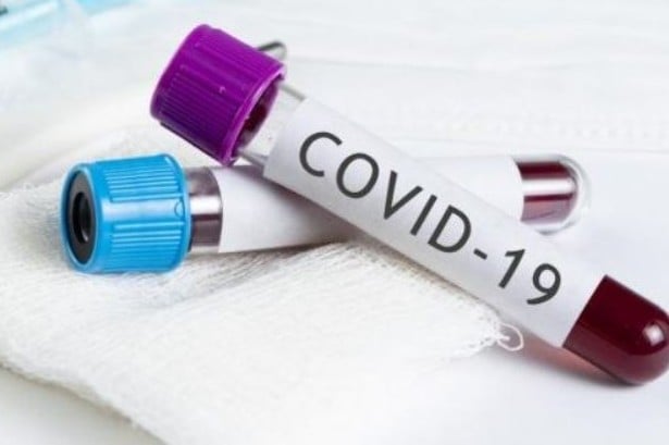 У працівника Ужгородського міськрайонного суду діагностовано COVID-19