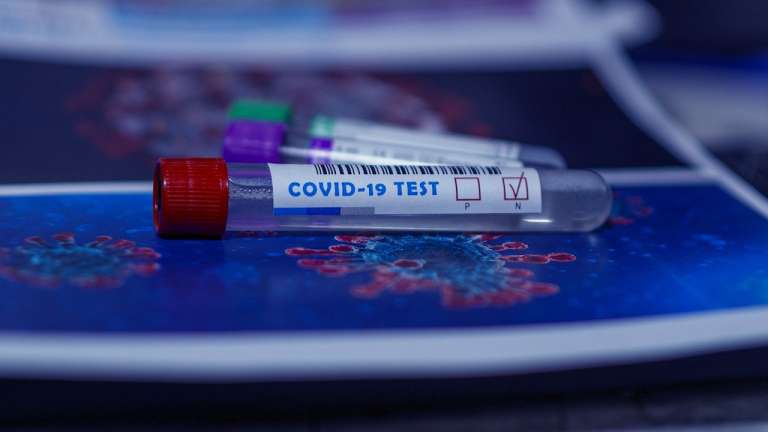 В Ужгороді за добу виявлено 56 випадків COVID-19, 3 людей померли