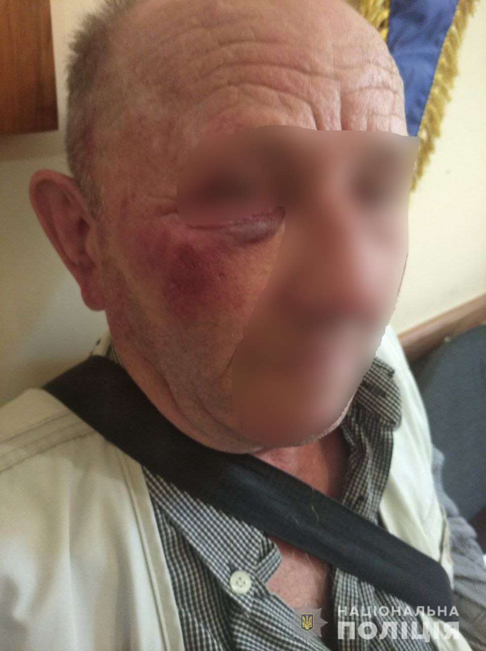 У Плоскому на Закарпатті двоє молодиків залізли у будинок пенсіонера, побили його й відібрали гроші (ФОТО, ВІДЕО)