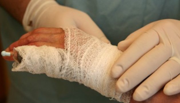 Під час пожежі у Мукачеві жінка отримала опіки обличчя та рук
