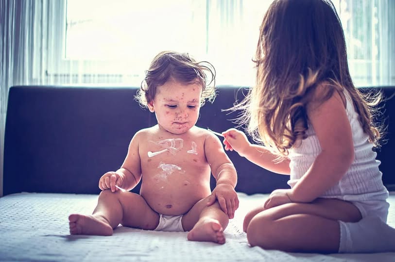 На Закарпатті ускладнюється епідситуація з кору, захворіли вже 167 осіб – ОВА