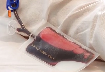 На Свалявщині здавали кров для потреб східного фронту (ВІДЕО)